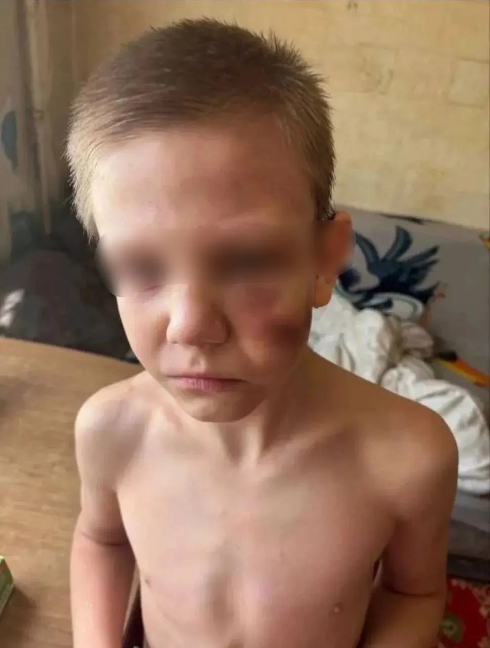 Мальчик, по словам соседей, неоднократно просил помощи и сообщал о побоях со стороны отца; несмотря на обращения в школу, полицию и органы опеки, ребёнок остаётся с отцом.